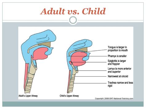 Airway Management In Pediatric Patients Ppt Download
