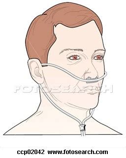 However, the maximal flow rates that these devices can deliver are limited because of the discomfort generated secondary to insufficient heat and humidity provided to the gas administered. Nursing.com: Oxygen Delivery Devices
