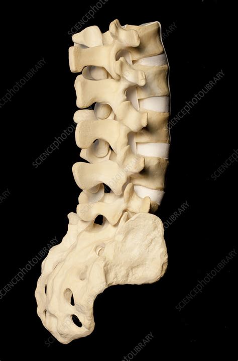 3d Printed Anatomical Lower Spine Model Stock Image C0297056