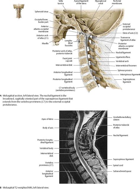 The ligamentum flavum limits spinal flexion (bending forward), especially abrupt flexion. Bones, Ligaments & Joints - Atlas of Anatomy