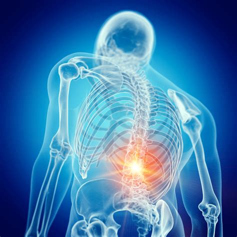 Areas Of The Back Pain Sacroiliac Joint Injection Ainsworth