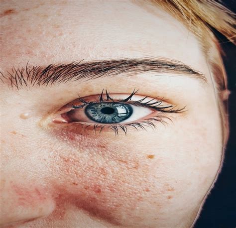 5 Must Know Tips For Eye Allergy Sufferers This Lady Blogs