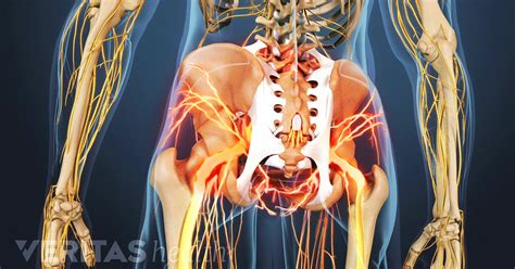 Care guide for ketogenic diet. Ankylosing Spondylitis