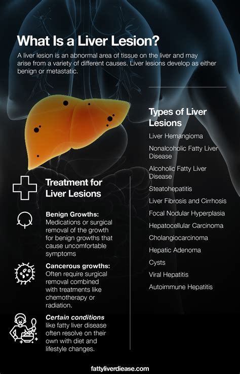 What Does It Mean To Have Liver Lesions Fatty Liver Disease