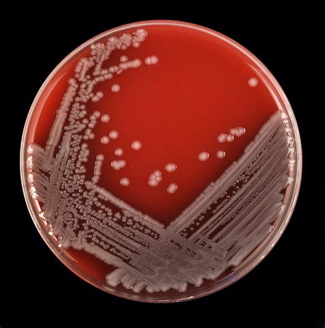 Escherichia Coli On Blood Agar A Photo On Flickriver