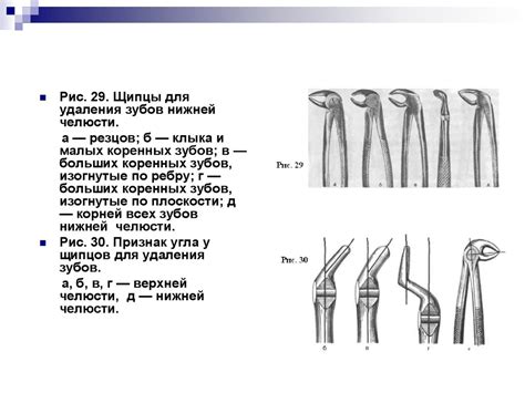 Боль является первым признаком развития воспалительного процесса в полости рта. Операция удаления зуба - презентация онлайн