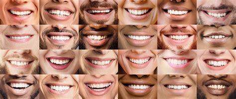 Smile Gallery Dicesare And Associates Periodontist Red Bank Nj