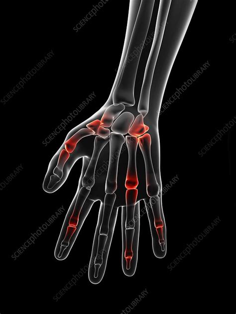 Human Finger Joints Artwork Stock Image F0095775 Science Photo