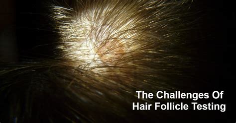 3 Hairy Issues With Hair Follicle Testing
