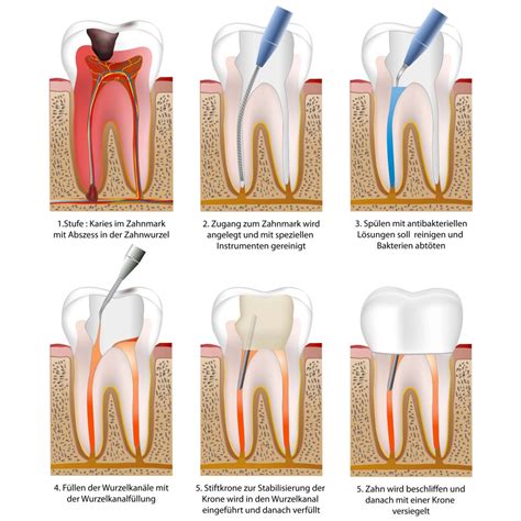 Aufbau Und Anatomie Des Zahnes