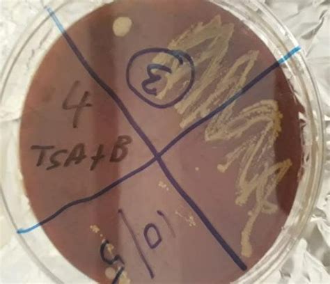 Brucella Growth On The Tryptone Soy Agar With Blood The 611 Of Culture