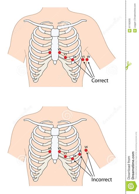 Ecg Lead Placement Stock Vector Illustration Of Locations