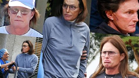 How He’ll Do It Doctors Reveal Steps Bruce Jenner Will Likely Take In His Transition The Road