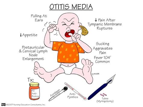 Nursing Mnemonics And Tips Otitis Media Nursing Mnemonics Pediatric