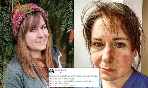Intensive Care Nurse Posts Picture Of Her Exhausted Face Bruised By