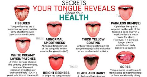 Warning Signs Your Tongue Might Be Sending About Your Health