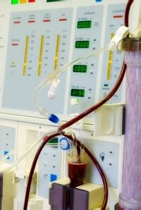 Sepsis can be the clinical manifestation of infections acquired both in the community setting or in health care facilities. Sepsis Treatment - Sepsis Alliance