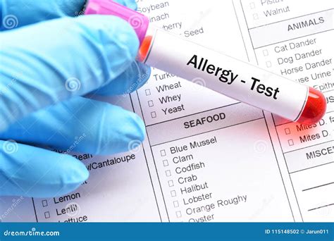 prueba de la alergia alimentaria foto de archivo imagen de tubo sangre 115148502