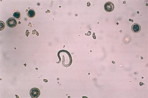 Toxocara Canis And Embryonated Egg With Larva Stock Image Everypixel