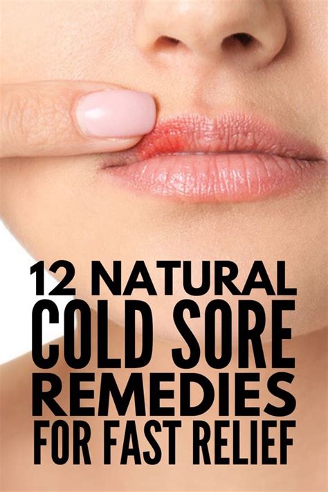 fast and effective 12 natural cold sore remedies that work wellness magazine
