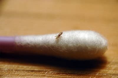 What Does Lice Look Like? Find Out With These Head Lice ...
