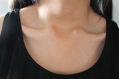 Why Do Some People Have Such Prominent Collar Bones While Others Seem