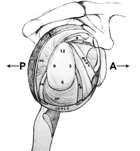 Schematic Drawing Of The Shoulder Joint Capsule Indicating The Location