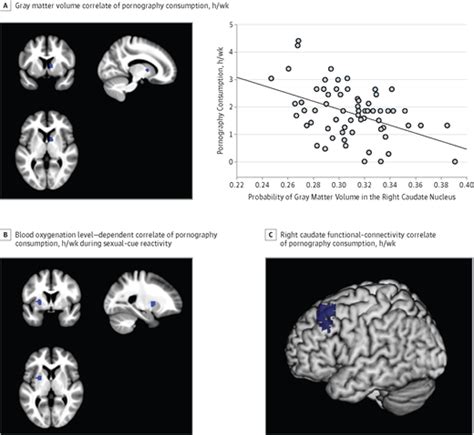 Brain Structure And Functional Connectivity Associated With Pornography