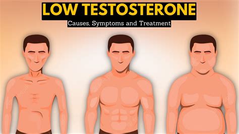 Low Testosterone Low T Causes Signs And Symptoms Diagnosis And