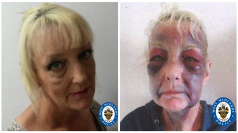 The term domestic violence refers to abusive behavior in any personal relationship that allows one partner to intimidate, or to gain power and control over the other. Domestic violence victim shares horrific image as partner ...