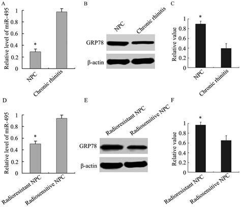 analysis of mir 495 and grp78 expression in npc and chronic rhinitis download scientific