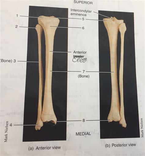 Tibia Bone Labeled