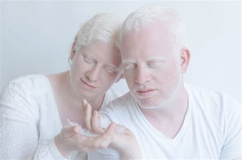 Yulia Taits S Porcelain Beauty Series Albinism Photographs Yulia Taits Part POPSUGAR