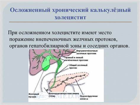 Желчный Пузырь Воспаление Симптомы Лечение Диета — Похудение Диета Картинка - Желчный Пузырь Воспаление Симптомы Лечение Диета — Похудение Диета