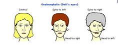Nursing on Pinterest | Nursing Mnemonics, Surgical Nursing ...