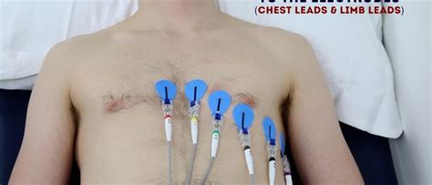 How To Record An Ecg Osce Guide Geeky Medics