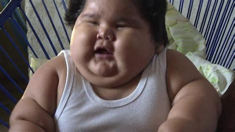 ทำไมทารกคนนี้ถึงมีน้ำหนักตัวมากผิดปกติ? - BBC News ไทย