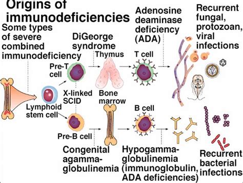 Immunodeficiency And Its Type Overall Science