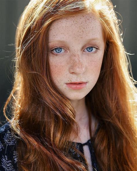 Pin By Graham Struwig On Freckles Honey Blonde Hair Redhead Ginger