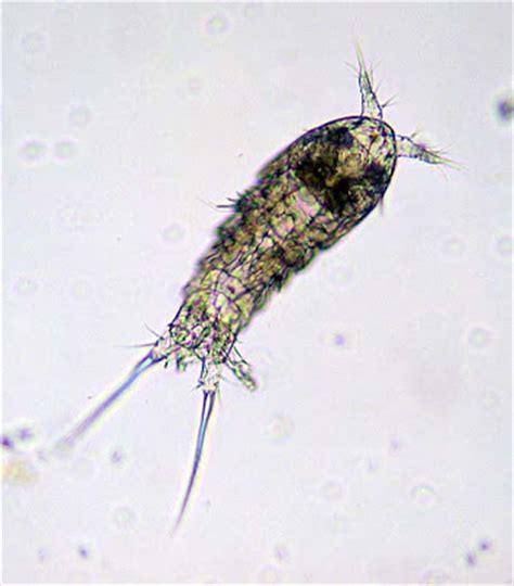 Admittedly, testing the water quality should be done whether the water is murky. Beyond the Human Eye: Pond Plankton