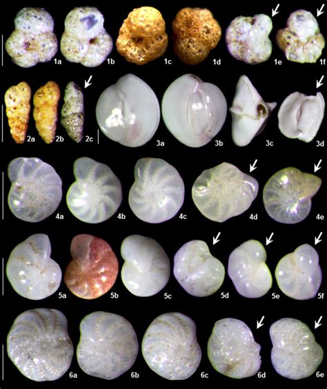 Microphotographs Of Dominant And Common Species Of Benthic Foraminifera