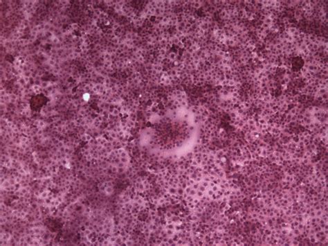 Distemper Virus, Phocine; Phocine distemper virus; Seal Distemper Virus