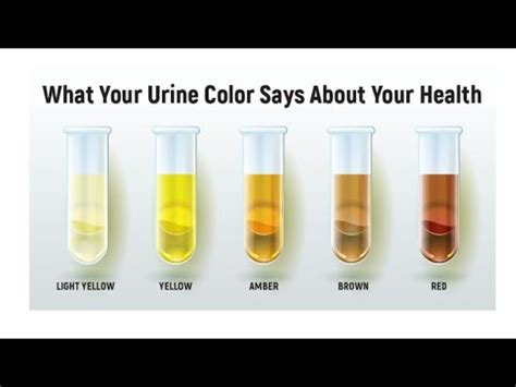What Your Urine Color Says About Your Health Pale Yellow Amber Brown Red Green Orange