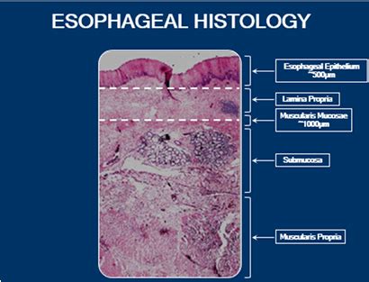 Layers Of Esophagus Histology