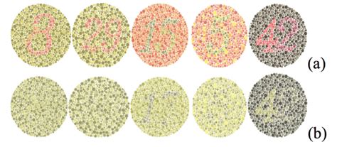 Ishihara Color Test Plates 2 3 6 And Plate 10 Is Shown For A Person