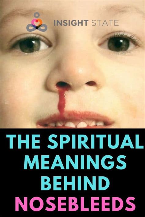 Nosebleeds also occur in hot dry climates with low humidity, or when there is a change in the seasons. The Spiritual Meanings Behind Nosebleeds - Niche United ...