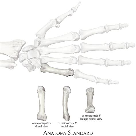 Bones Of The Hand Metacarpal Bones