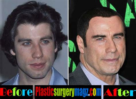 John Travolta Plastic Surgery John Travolta Face Plastic Plastic Surgery Magazine