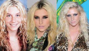 Beth Chapman Plastic Surgery Before and After Pictures 2018