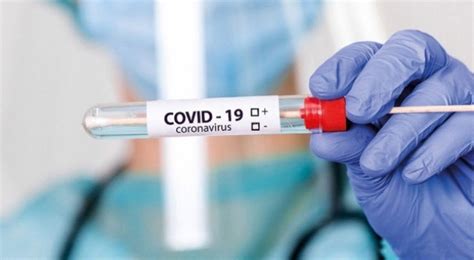 Haftalık koronavirüs tablosu açıklandı 30 Mayıs 5 Haziran Türkiye